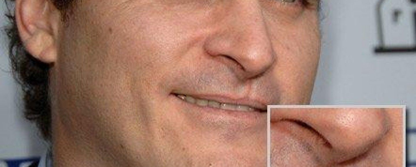 I piccoli petti privati