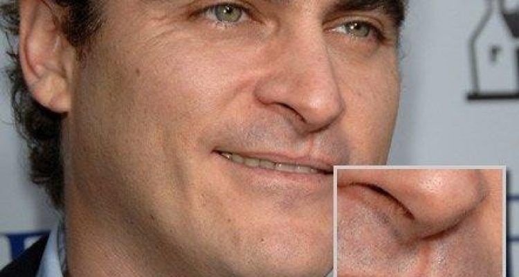 Chirurgie di plastica su un petto in Cheboksary