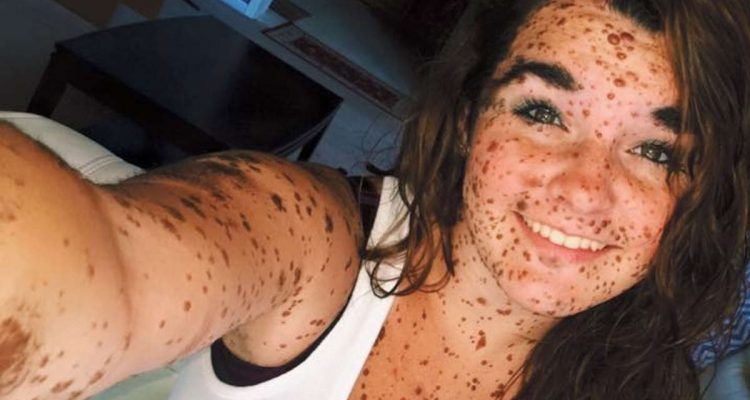 Contro pigmentary nota la crema di gel