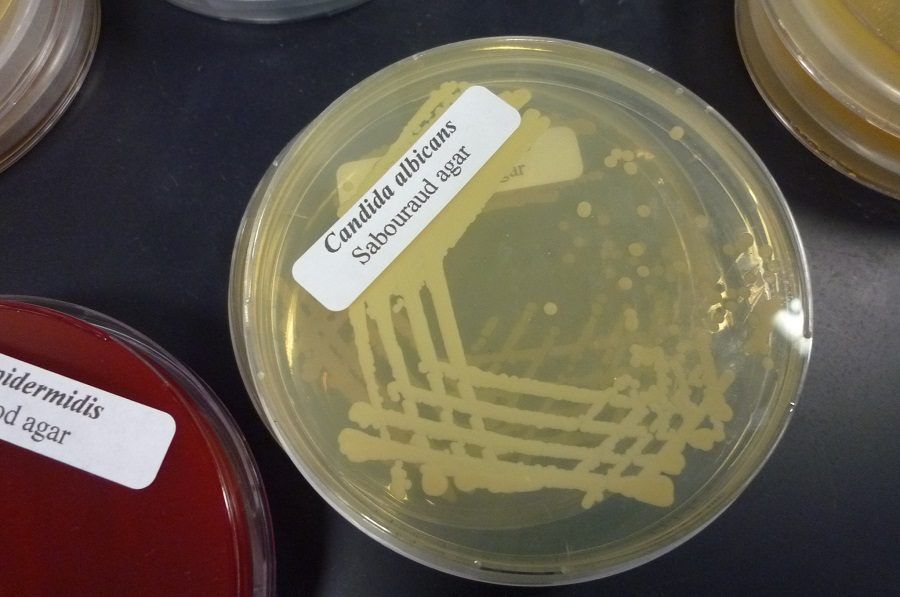 Esame colturale per la ricerca della Candida