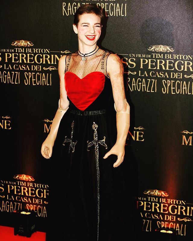 Bebe Vio sul red carpet di Miss Peregrine a Roma