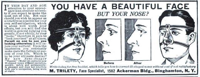 TRADOS NOSE-SHAPER, la macchina per aggiustare il naso