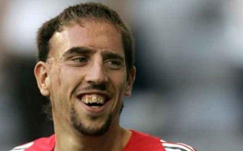 Frank Ribery