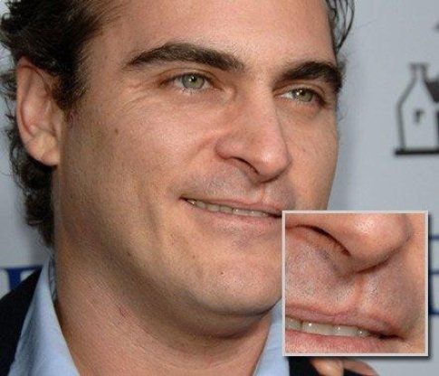 Joaquin Phoenix ha il labbro leporino