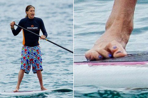 Steven Tyler ha un piede deformato