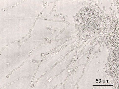 Miceti di Candida Albicans visti al microscopio