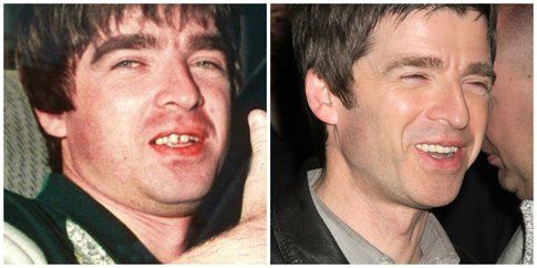 Noel Gallagher