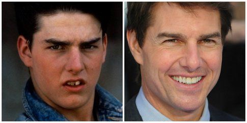 Tom Cruise