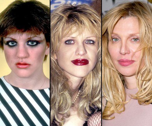 Courtney Love prima e dopo la chirurgia