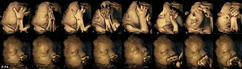 Mamme che fumano e danni al feto - Fonte: DailyMail