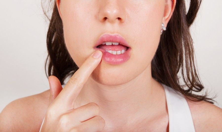 Young woman examining herpes in her face