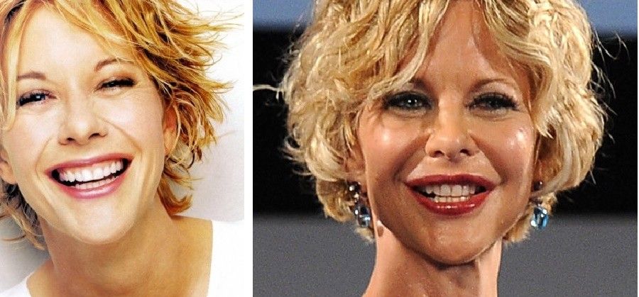 meg-ryan