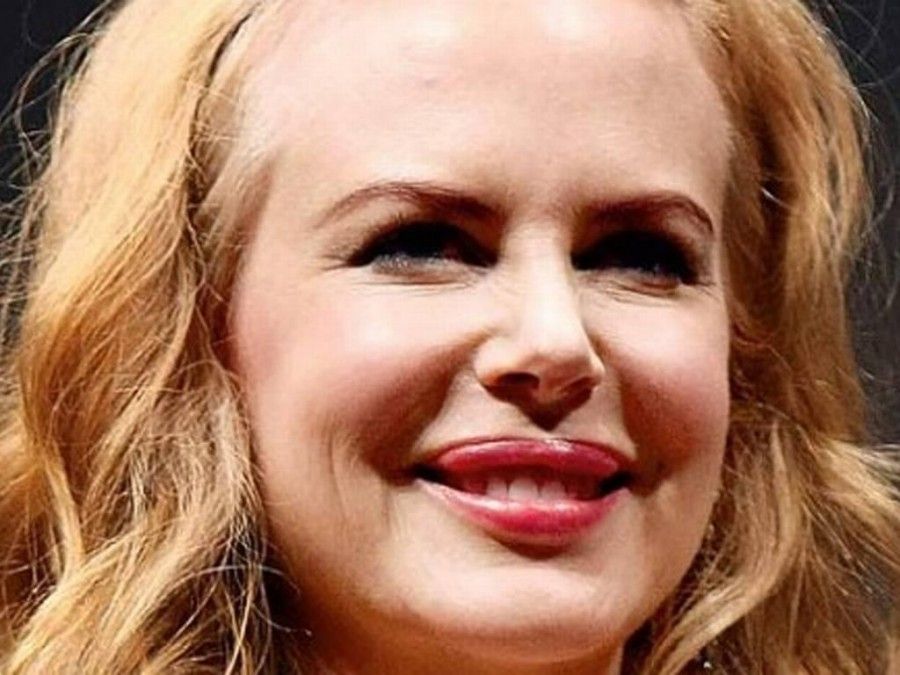 Nicole Kidman si è pentita del botox