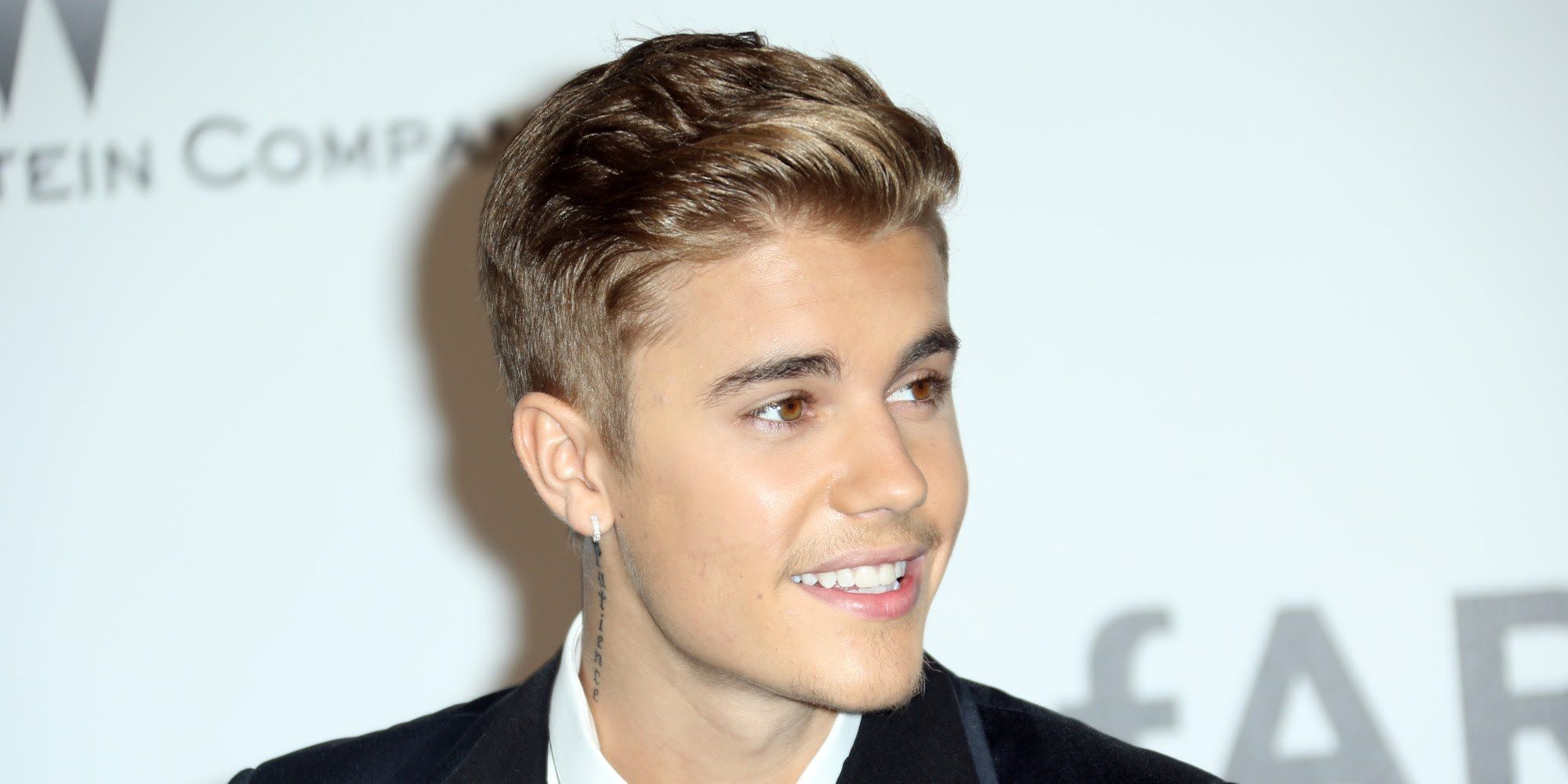 Justin Bieber ha la malattia di Lyme