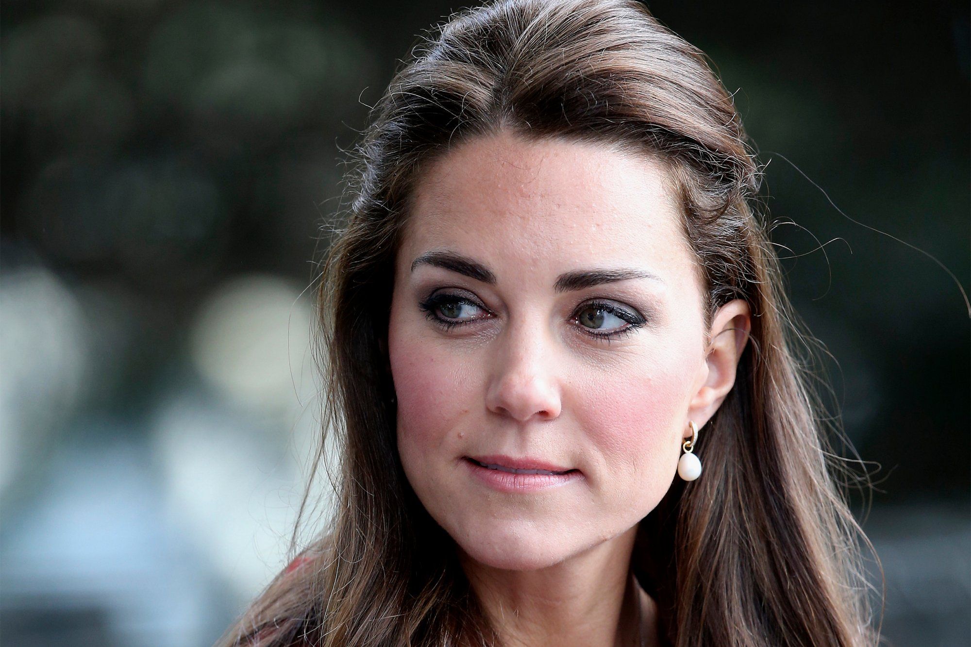 Il mistero dei cerotti sulle mani di Kate Middleton