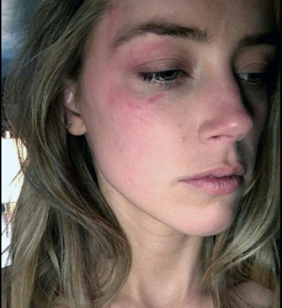 Amber Heard accusa Johnny Depp di violenza domestica