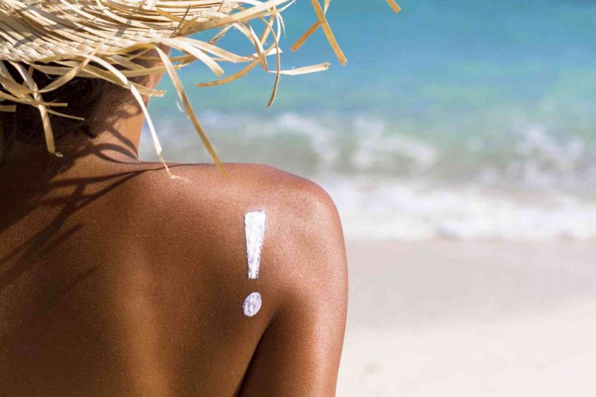 Eritema solare: come prevenirlo e come curarlo