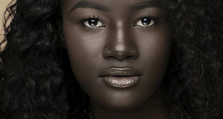 La storia della modella dalla pelle nera vittima dei bulli ...