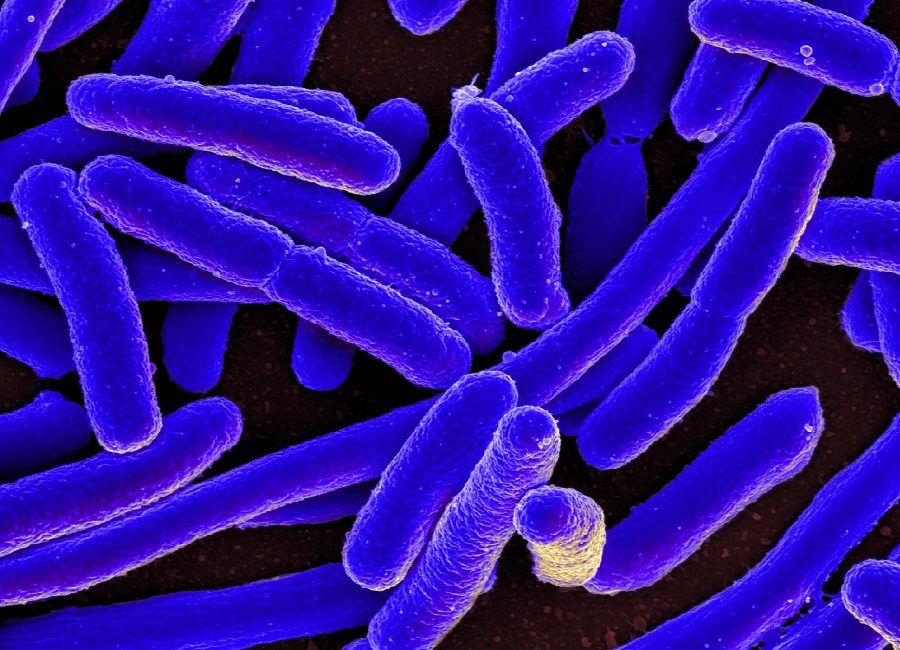 Escherichia coli,batteri presenti nella nostra flora intestinale
