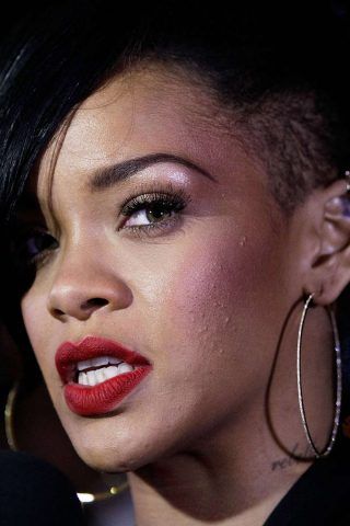 Rihanna è una delle tante star, comunque bellissime, con problemi di acne.