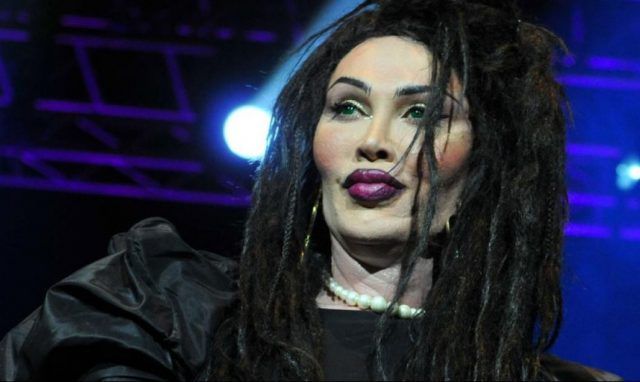 Pete Burns, frontman dei Dead or Alive