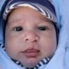 perche il bebe nasce con il labbro leporino