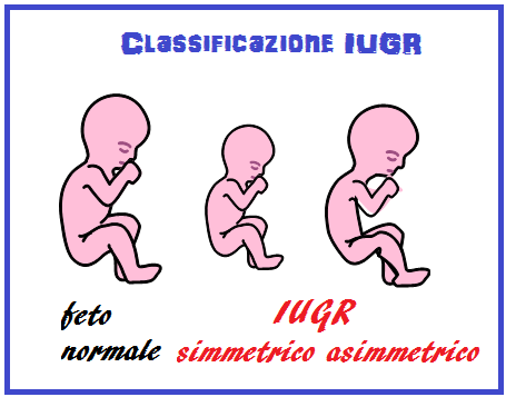 IUGR-classificazione