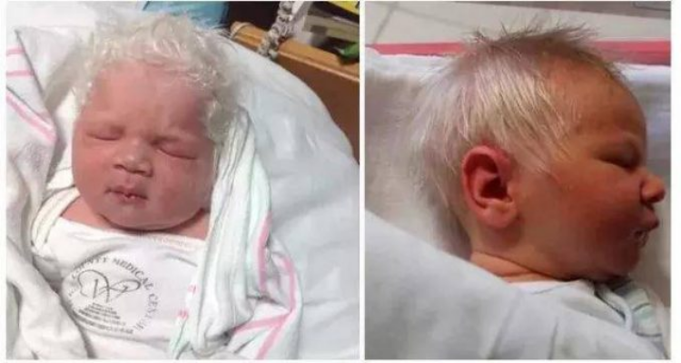 Un bellissimo bambino nasce con i capelli bianchi, le foto diventano virali!