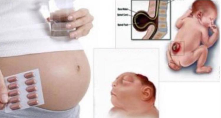 Acido folico in gravidanza. L’assunzione è molto importante.