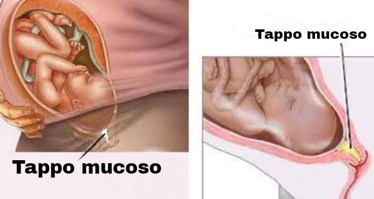 Che cos’è il tappo mucoso? Quando viene espulso? Come riconoscerlo?