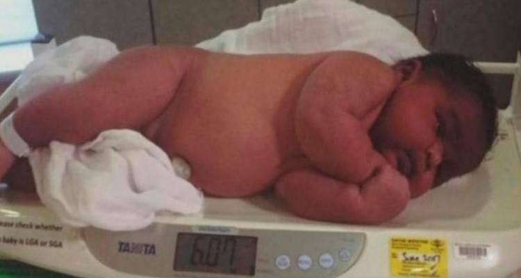 Il neonato più grande del mondo: pesa 6.08 kg! E’ record!