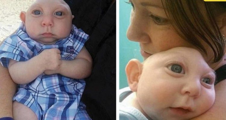 Il miracolo di Jaxon! Il bambino nato senza una parte di cranio compie 2 anni!