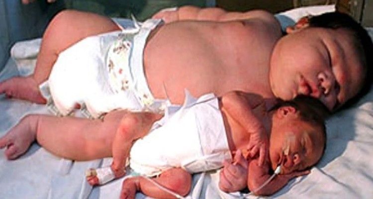 I neonati più grandi del mondo