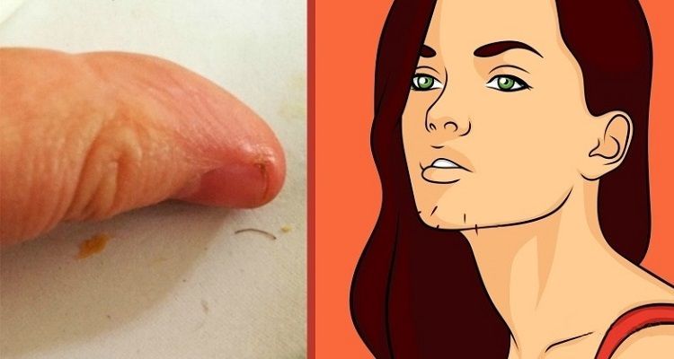 I peli sotto il mento possono dirci molte cose. Ecco quali