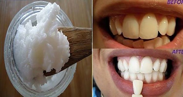L’ingrediente che vi cambierà la vita
