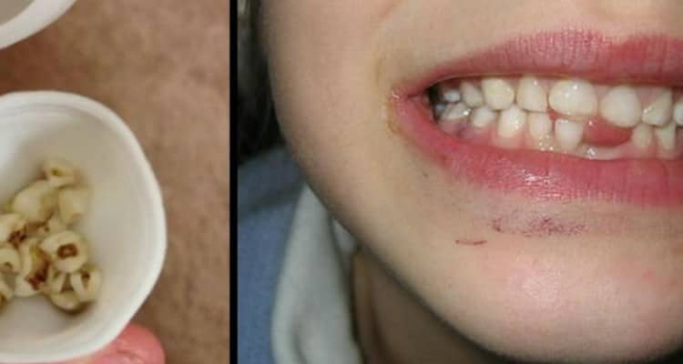 L’appello dei medici: non buttare i denti da latte di tuo figlio