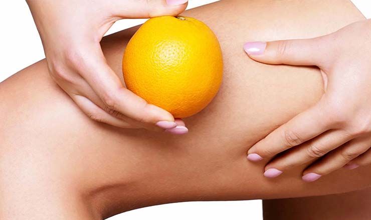 Sport consigliati contro la cellulite