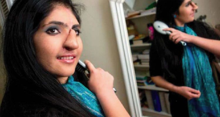 La famiglia di questa ragazza l’ha data a un mostro che l’ha sfigurata