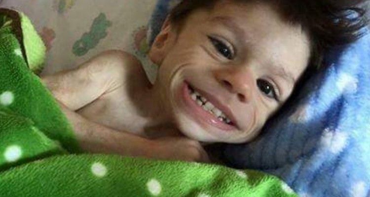 La storia di Ryan, il bambino guerriero che a 7 anni pesava 3 kg, ha commosso il mondo