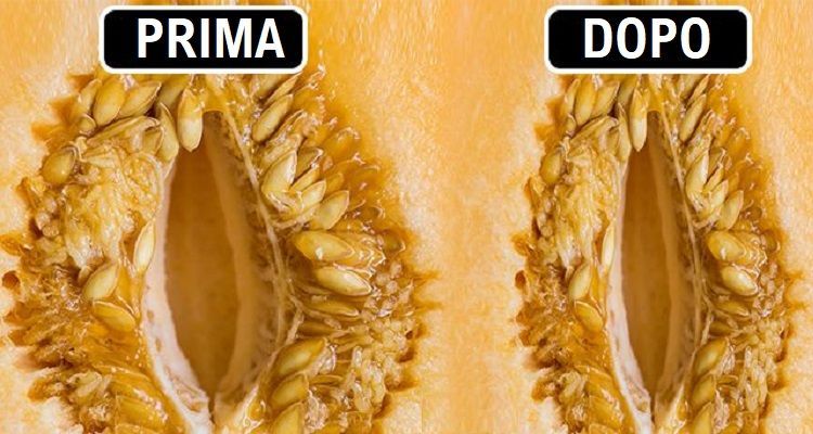 7 metodi naturali per tornare ‘come mamma ti ha fatta la giù’