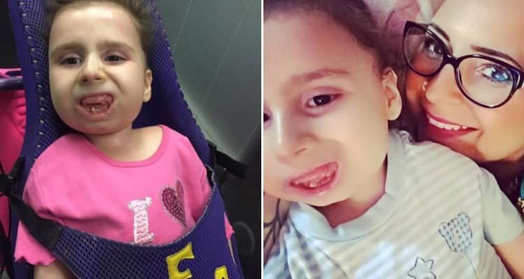 E’ morta Bea, la bambina di ‘pietra’