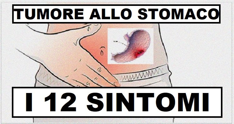 I 12 sintomi del tumore allo stomaco