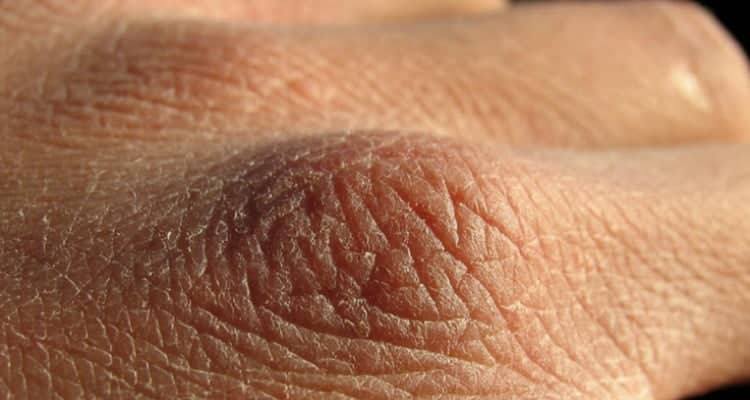 8 segnali di pericolo per i quali è necessario bere più acqua