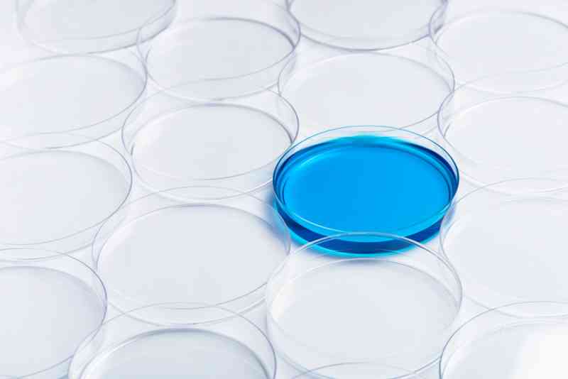 Il colore delle urine dice molto sul nostro stato di salute Bigodino