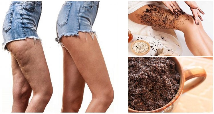 Le creme fai da te per dire addio per sempre a cellulite e smagliature