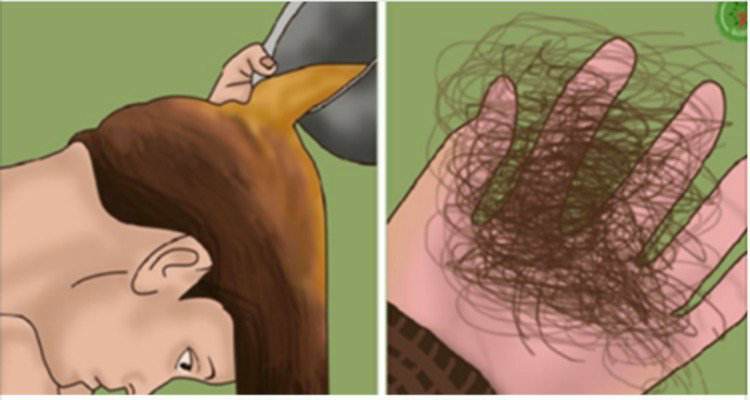 Due trucchi per evitare la perdita dei capelli