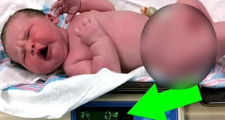 Pesava così tanto, che i medici pensavano che la bilancia fosse rotta