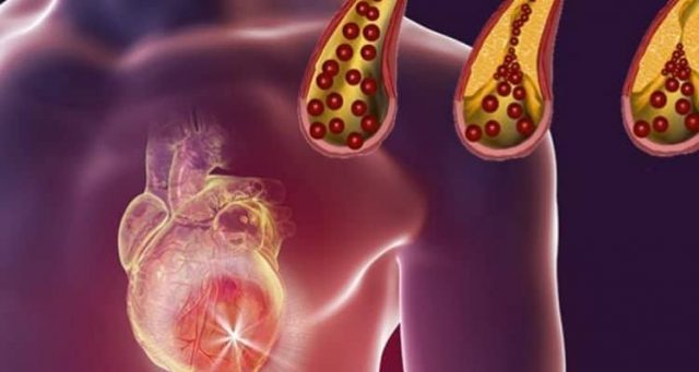 Otto Alimenti Che Devi Mangiare Ogni Giorno Per Mantenere