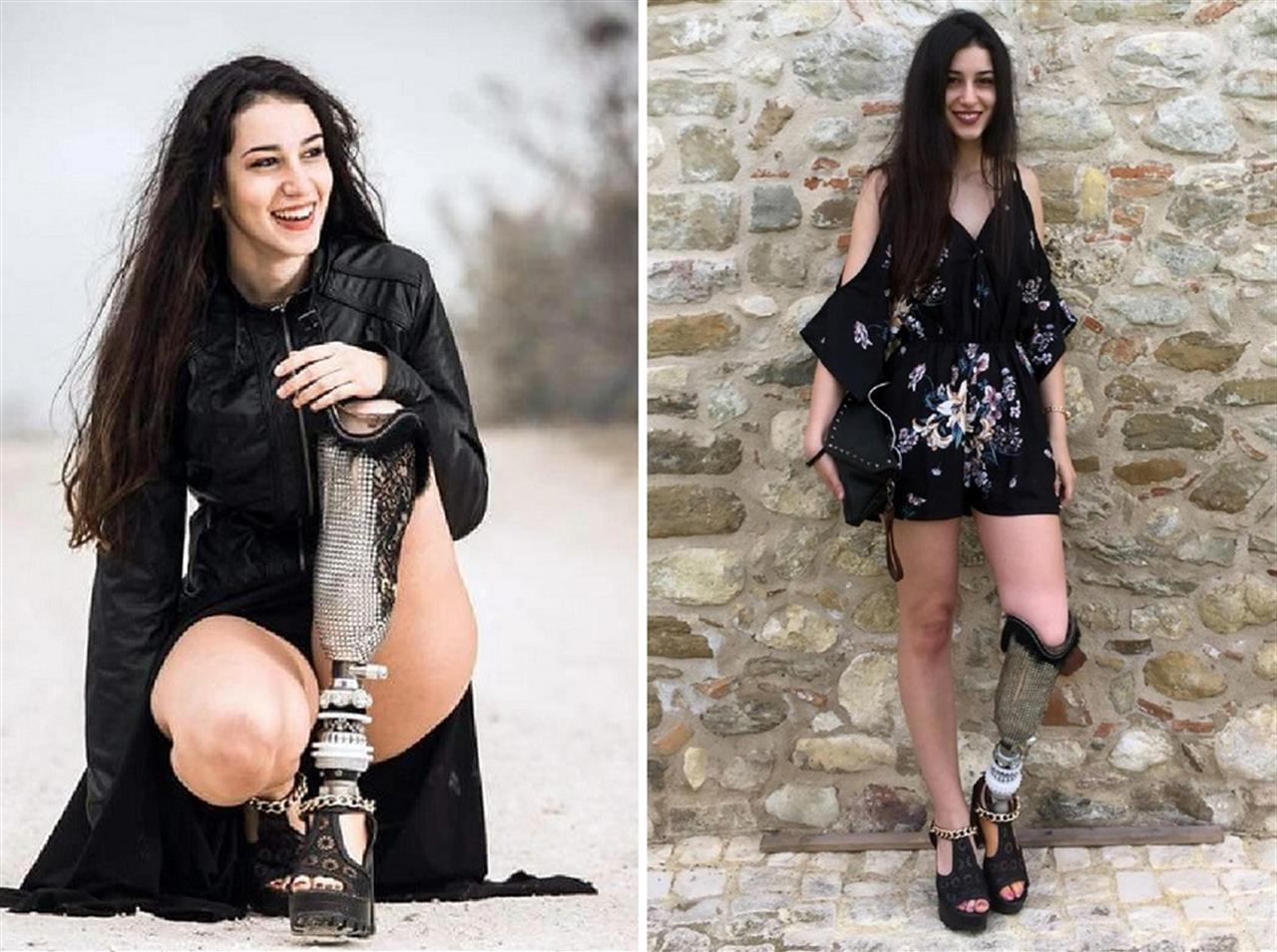 Chiara Bondi a Miss Italia con una protesi alla gamba sinistra