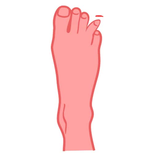 Quarto dito del piede